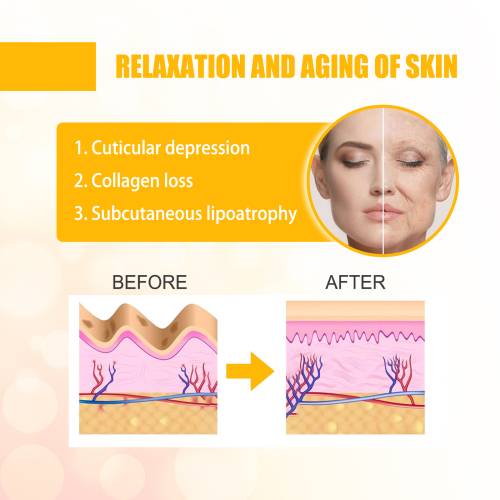 Collagen Smile Line Patches