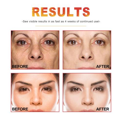 Vitamin C, Retinol & Hyaluronic Acid Face Serum