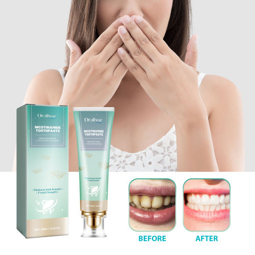 Niacinamide Toothpaste for Brighter Teeth