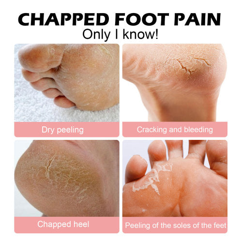 Hand & Foot Moisturizing Stick for Cracked Skin