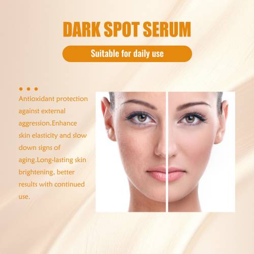 Dark Spot Serum with Turmeric & Kojic Acid, Brightening