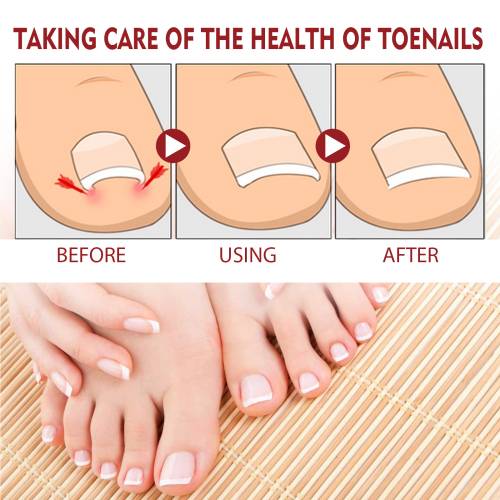 Nail Care Oil