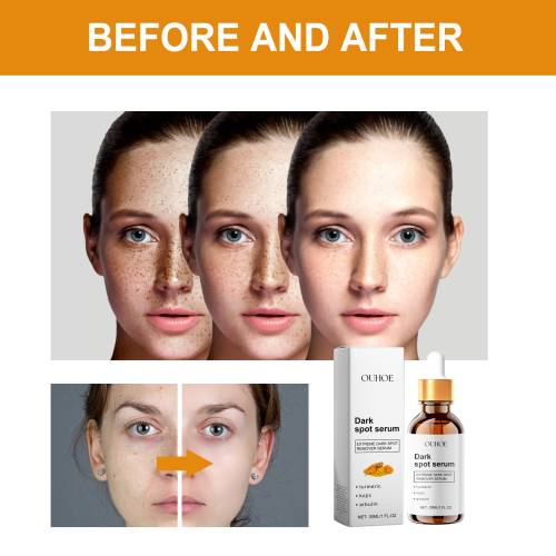 Dark Spot Serum with Turmeric & Kojic Acid, Brightening