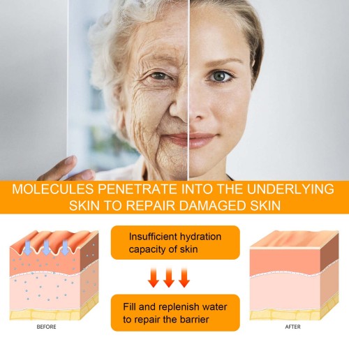 5D Peptide Eye Cream for Crow's Feet