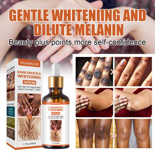 Brightening Serum for Knees, Elbows & Ankles, 50 g
