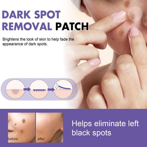 Dark Spot Patches with Niacinamide & Vitamin C
