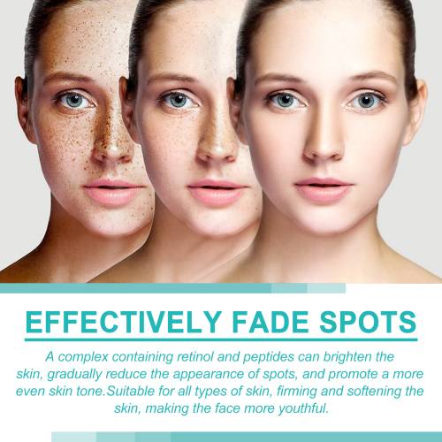 Moisturizing Face Cream for Spots & Dullness