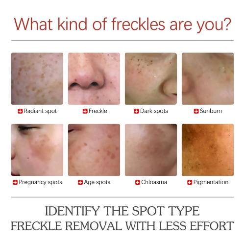 Dark Spot Cream with Retinol & Vitamin C