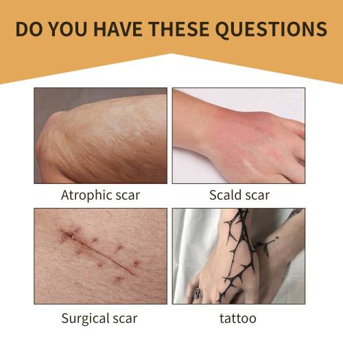 Invisible Skin Cover Patches
