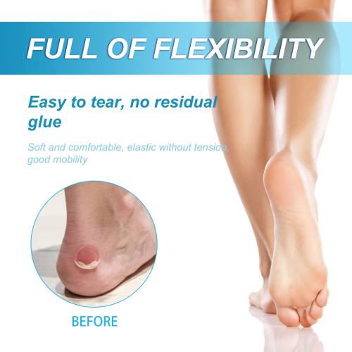 Anti-Chafe Stick for Thighs, Heels & Arms