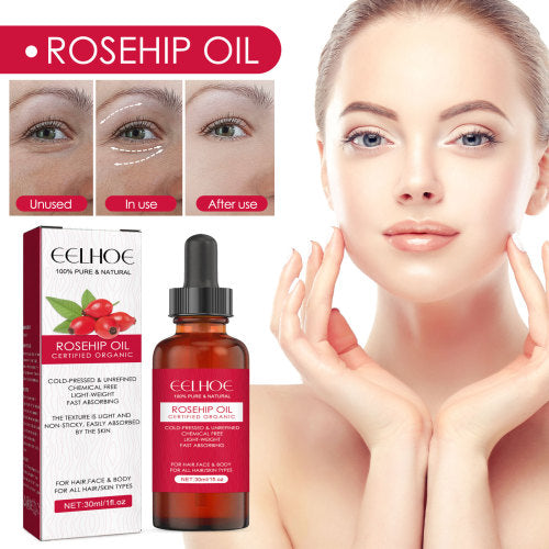 Rosehip Oil for Face, Body & Hair