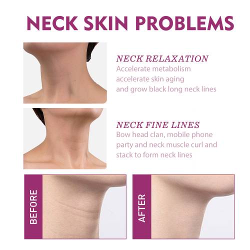 Collagen Neck Cream for Neck Lines