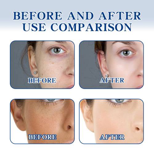 Niacinamide Brightening Face Cream with Hyaluronic Acid