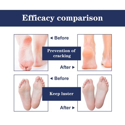 Silicone Heel Protectors