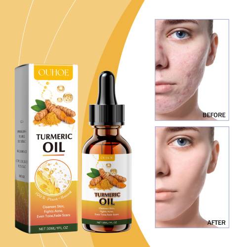 Turmeric Cleansing Oil with Kojic Acid