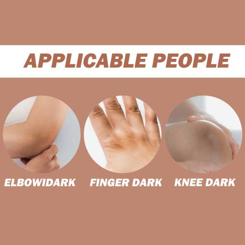 Brightening Cream for Elbows & Knees with Glutathione & Kojic Acid