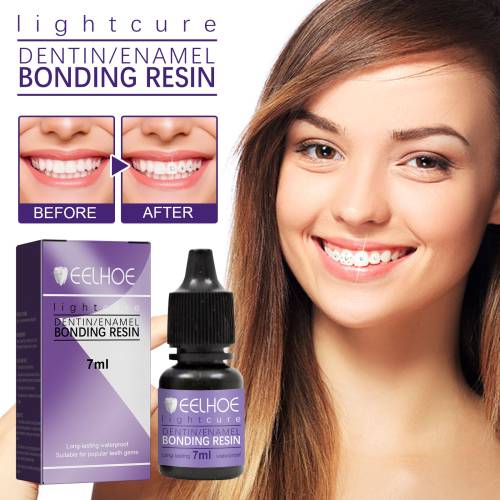 Tooth Gem Bonding Glue
