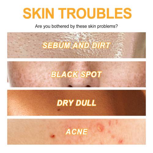 Vitamin C Exfoliating Face Gel for Blackheads