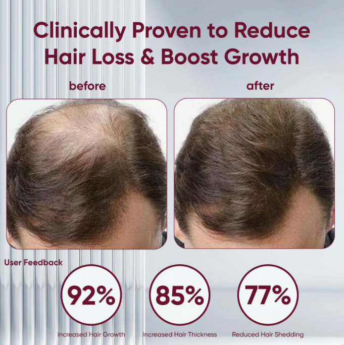 Rosemary & Onion Scalp Cleansing Shampoo for Smooth, Shiny Hair
