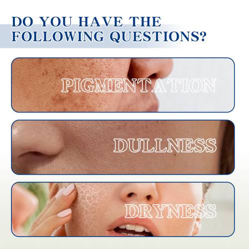 Niacinamide Brightening Face Cream with Hyaluronic Acid