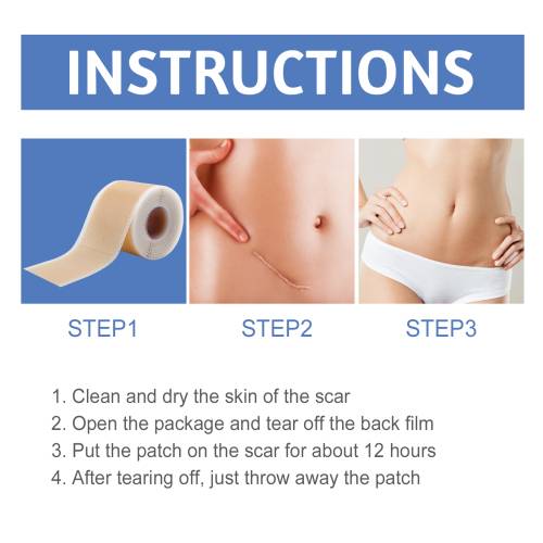 Silicone Gel Sheets