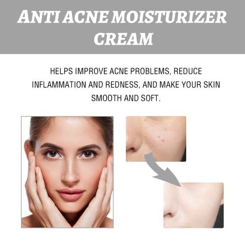 Niacinamide Hydrating Face Cream for Oily Skin