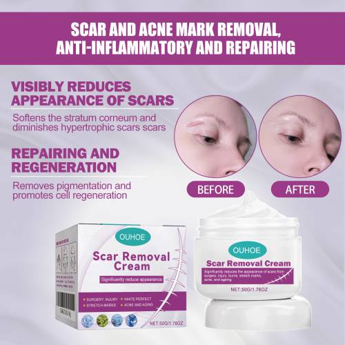 Licorice Hyaluronic Skin Cream