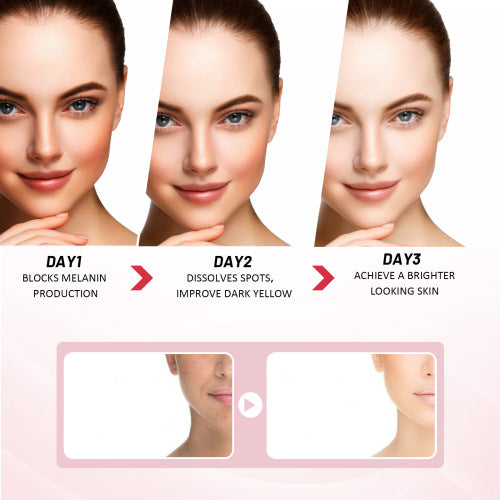 Gentle Face Moisturizer for Dark Spots, 25 g