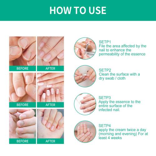Gentle Nail Care Solution