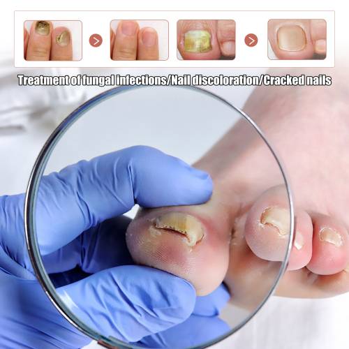Gentle Nail Care Solution
