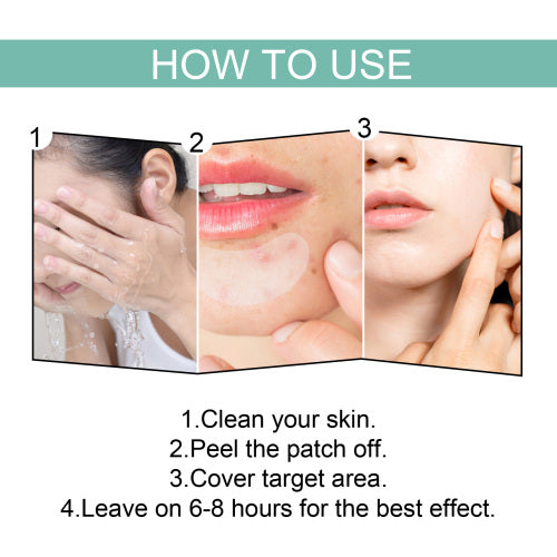 Gentle Pimple Cover Patches