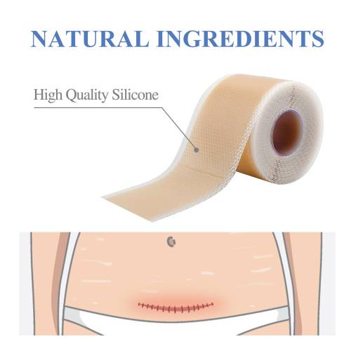 Silicone Gel Sheets