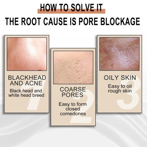 Glycolic Acid Exfoliating Face Essence for Blackheads