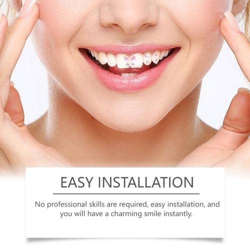 Crystal Tooth Gem Stickers, Universal Fit