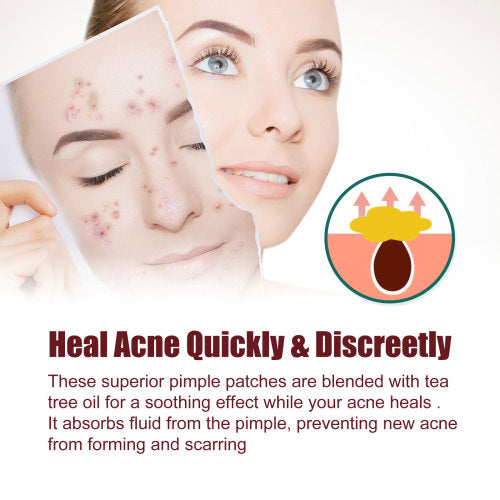 Hydrocolloid Pimple Patches with Witch Hazel
