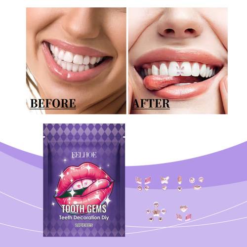 Crystal Tooth Gem Stickers, Universal Fit