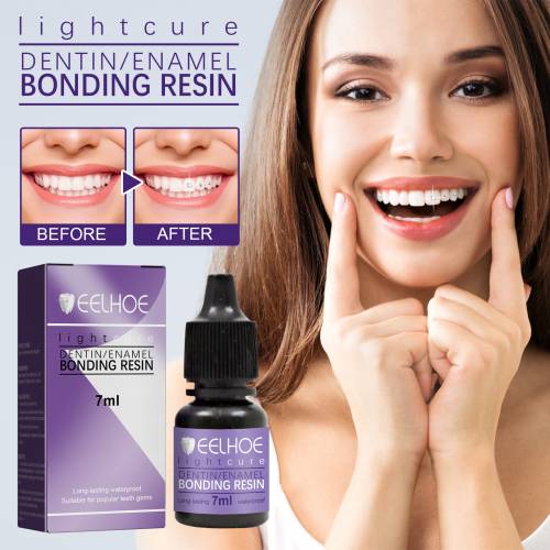 Tooth Gem Bonding Glue