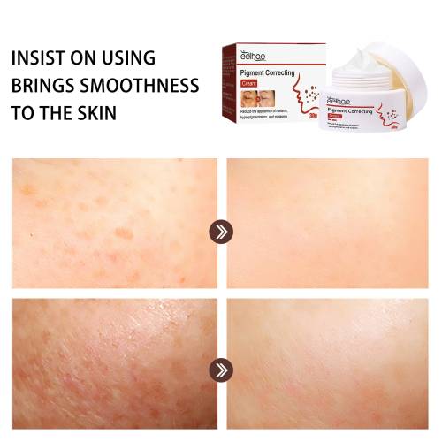 Dark Spot Cream with Retinol & Vitamin C