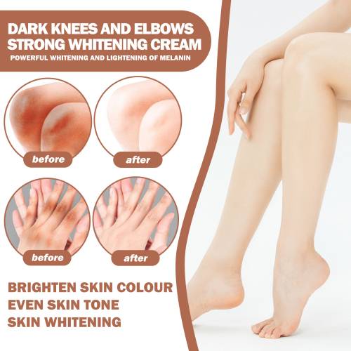 Brightening Cream for Elbows & Knees with Glutathione & Kojic Acid