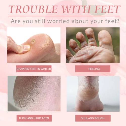 Peach Exfoliating Foot Mask for Dry, Rough Feet