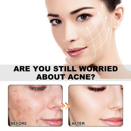 Sea Life Pimple Patches