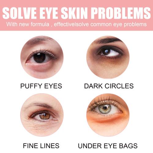 Pink Rose Under-Eye Patches