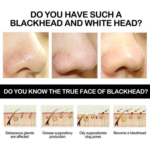Bamboo Charcoal Peel-Off Mask for Blackheads