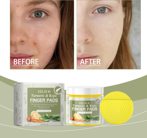 Turmeric Kojic Acid Cleansing Pads