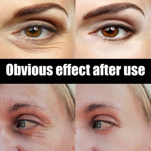 Astaxanthin & Caviar Eye Cream, Moisturizing & Firming, 20 g