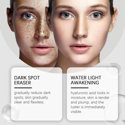 Vitamin C Dark Spot Lotion with Hyaluronic Acid