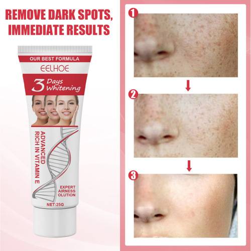 Gentle Face Moisturizer for Dark Spots, 25 g