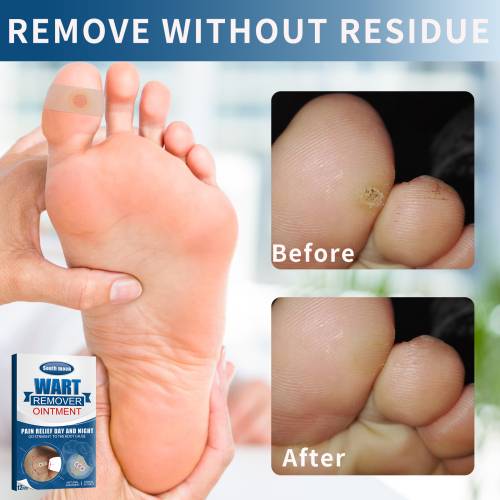 Skin Patches for Face & Neck