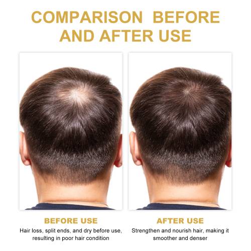 Rosemary Oil-Control Shampoo