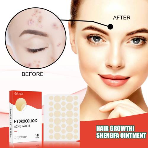 Invisible Hydrocolloid Pimple Patches, Waterproof